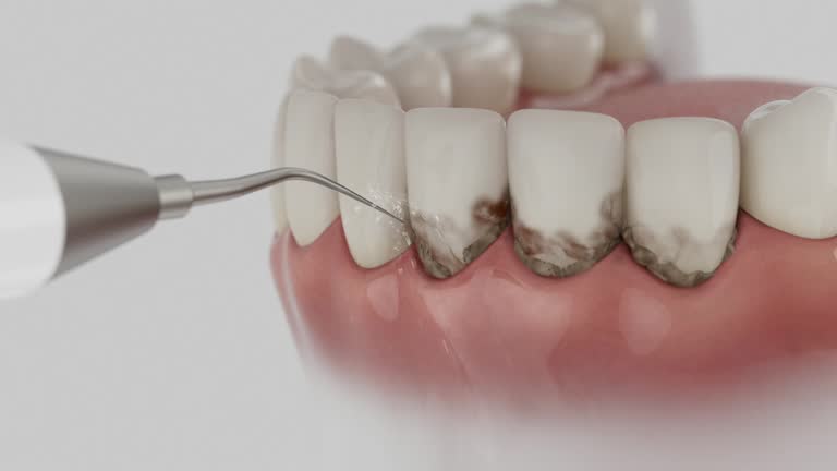 Reliable Wisdom Tooth Removal contractor in Decatur County County, TN by Dentist Open Now